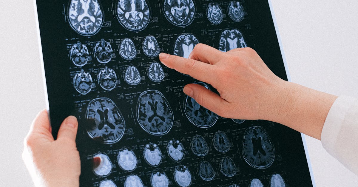 How long is neuro school?