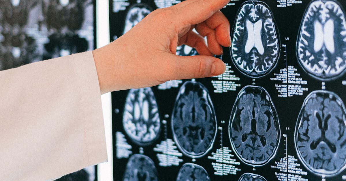 How many years is neurology training?