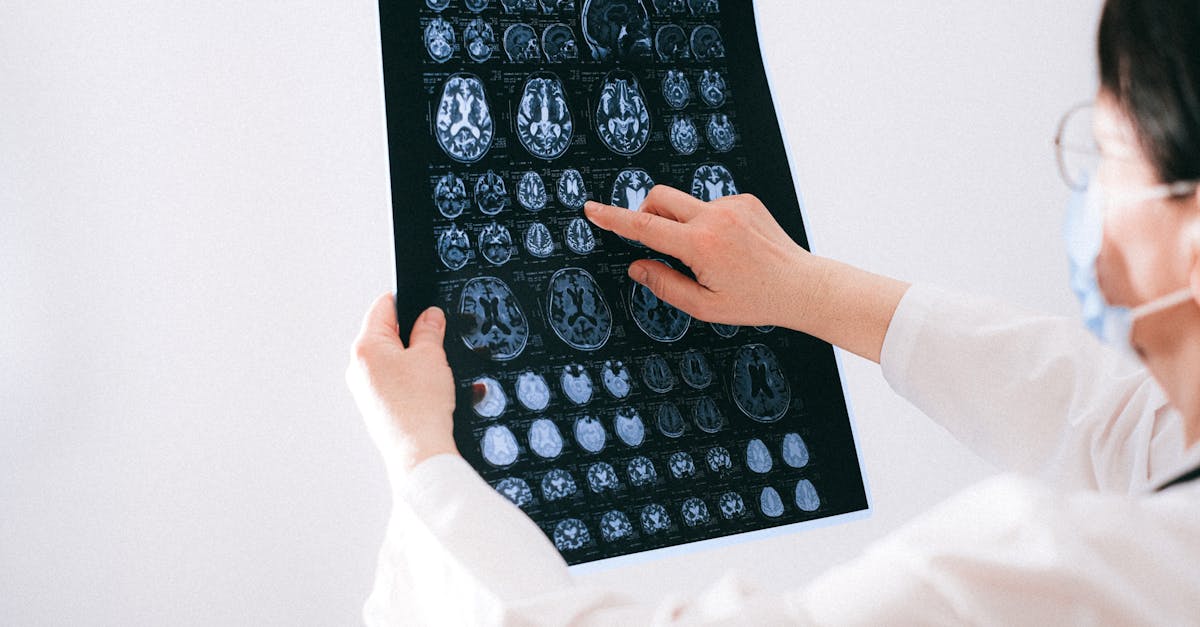 Is becoming a neurologist hard?