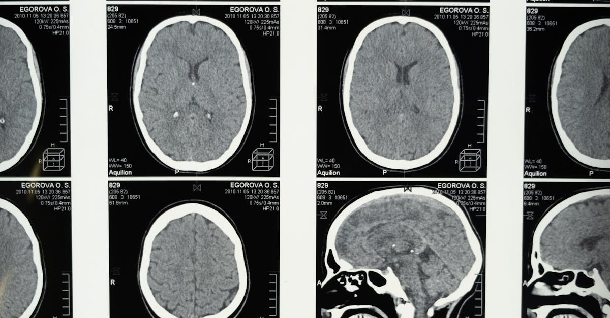 Is MD or DO better for neurology?