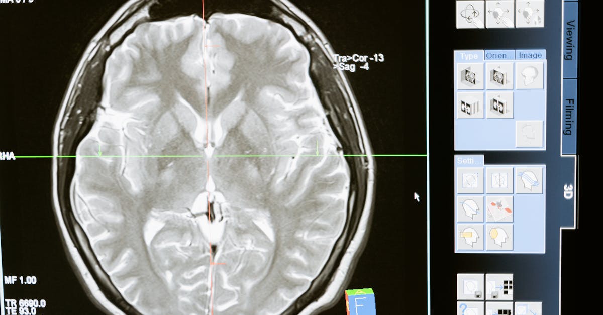 What degree is best for neurology?