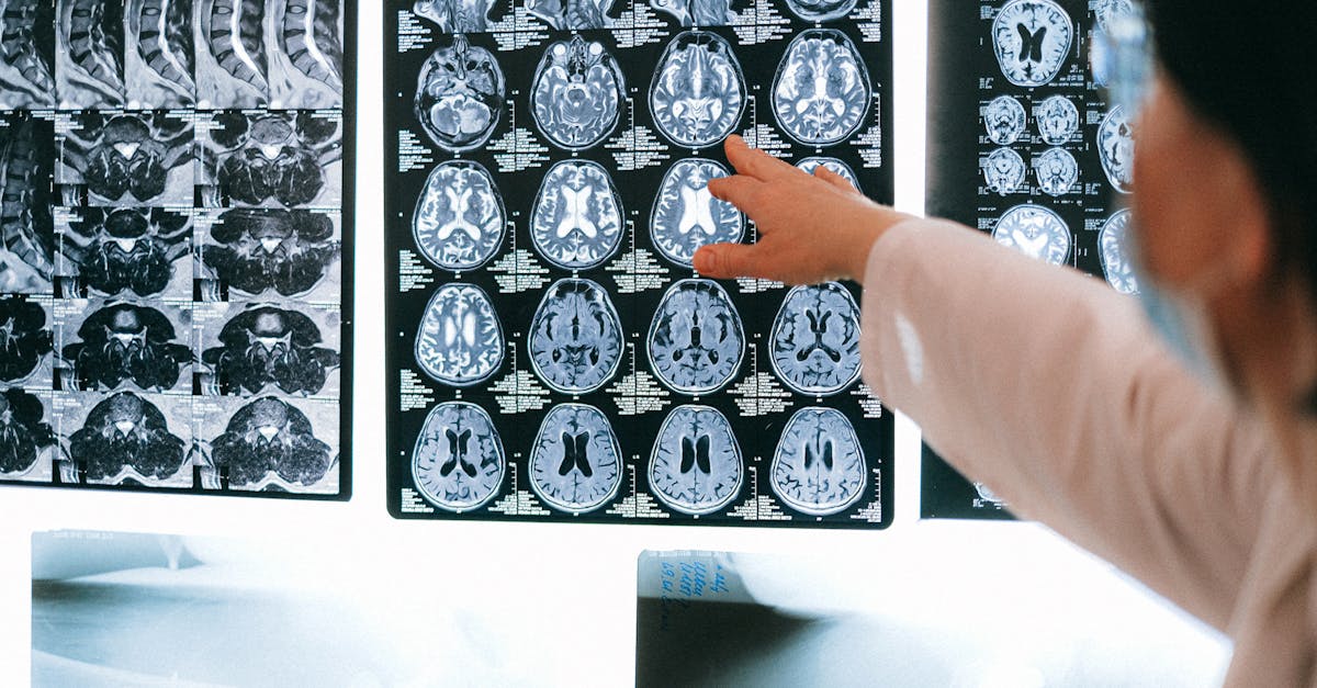 What do you need to study for neurology?