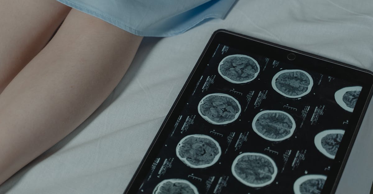 What GPA do you need to be a neurologist?