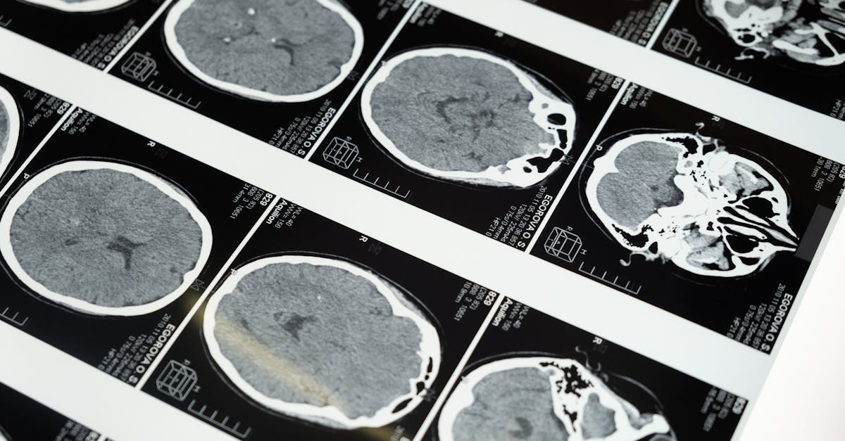 What is the trend in neurology journal?