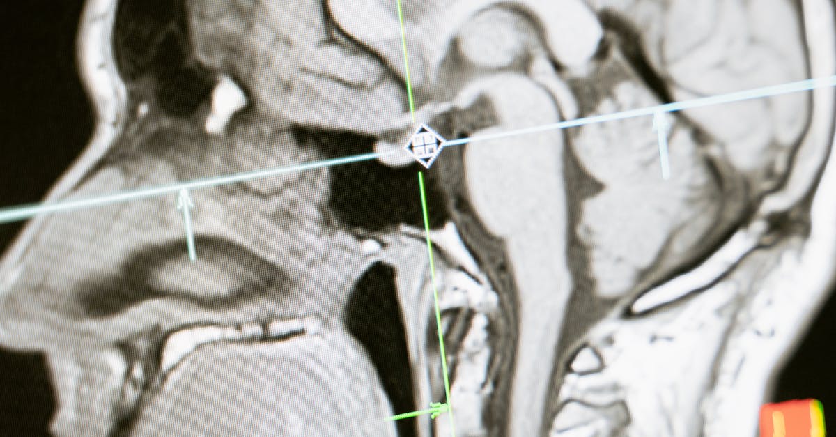What jobs require neurology?